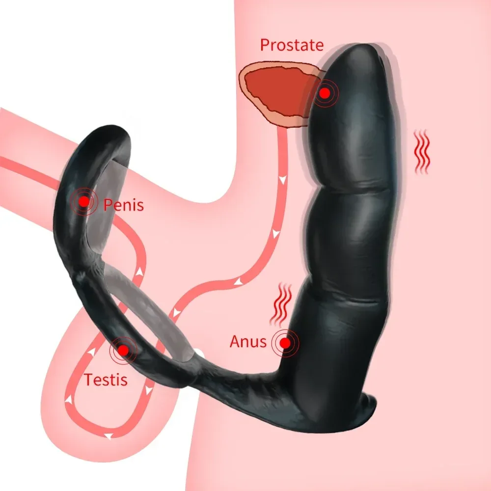 tpe prostate plug for men